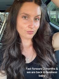 Swollen Face from Laser