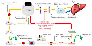 Maybe you would like to learn more about one of these? Cryopreserved Biopsy Tissues Of Rectal Cancer Liver Metastasis For Assessment Of Anticancer Drug Response In Vitro And In Vivo