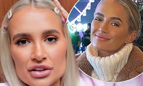 Molly Mae Hague says she looks five years younger after getting fillers  dissolved