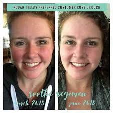 Melanie Stelting Rodan+Fields Independent Consultant