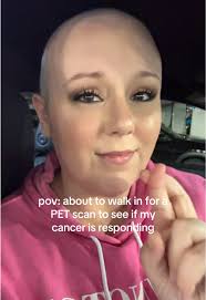 Facing a PET Scan: Hope for Cancer Recovery