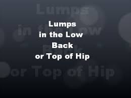 When one of the sacroiliac joints is stuck and unmoving, as can often occur with pelvic torsion (see postural distortion above) sacroiliac joint dysfunction may result leading to lower back. Lumps In Low Back Top Of Hip Youtube