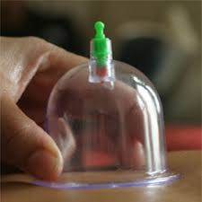 Taalkundige en religieuze betekenis van hijama (of hijaama of hijaamah etc.) geschiedenis van hijama hijaamah ook wel cupping in het engels genoemd en koppen in het nederlands heeft een lange. Hijama Or Cupping Wet Dry Portland Lake Oswego Oregon