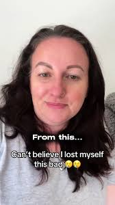 Regaining Confidence: My Gastric Sleeve Journey