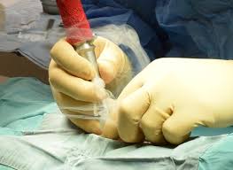 Declaw surgery is extremely painful for cats, as any amputation surgery is. Declaw
