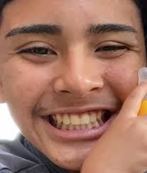 Bryan Ernesto Galindo, age 15