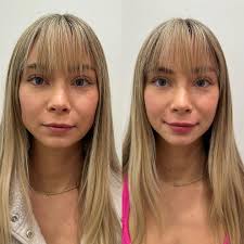 L I P • F L I P • W I T H • F I L L E R Have you been