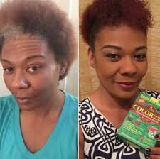 See more ideas about hair rinse, natural hair growth, natural hair styles. Natural Hair Products For Hair Loss Hair Loss Kit New York Ny