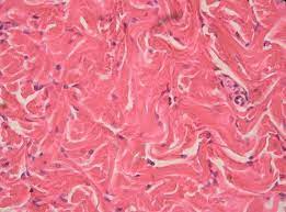Dense Irregular Connective Tissue Human Anatomy And Physiology Cell Biology Anatomy And Physiology