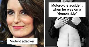 Meanings and origins, popularity, pronunciations, sibling names, surveys.and add your own insights! Celebrities That Have Visible Scars Share Stories Behind Them Bored Panda