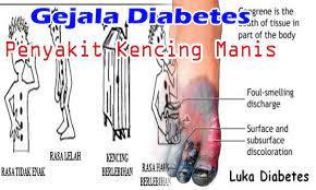 Maybe you would like to learn more about one of these? Gejala Diabetes Atau Penyakit Kencing Manis Fur Android Apk Herunterladen