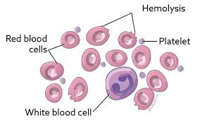 When the flow is slow enough and the trapping force overcomes the optical trapping of several red blood cells causes capillary blockage. Autoimmune Hemolytic Anemia In Dogs Vca Animal Hospital