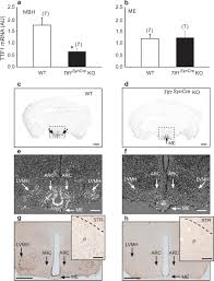 Découvrez pourquoi the ferraro group est la meilleure entreprise pour vous ! Deletion Of The Ttf1 Gene In Differentiated Neurons Disrupts Female Reproduction Without Impairing Basal Ganglia Function Journal Of Neuroscience