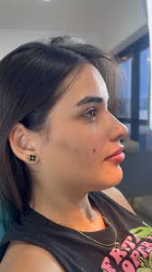 Como ter um rosto de mulherão em 3 passos! 🌸, Minha paciente Vitória,  ficou com o rosto ainda mais marcante, desenhado e jovial. Quer você também  ter esses resultados? , Dra. Bárbara Gama , // CROSP ...