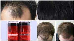 Can you leave oil on for 2 days? 10 Days Hair Oil Review After Applying For 20 Days Continuously Youtube