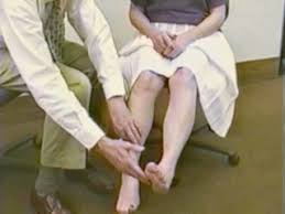 Image result for Rapid Alternating Movements