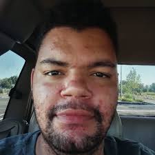 Do I need to replace the rotors when replacing the brakes in my car?