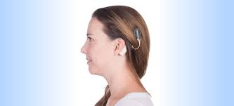 Image result for Cochlear Implant
