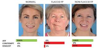 Her expression was one of open contempt.deep contempt (=great contempt)there is a deep contempt for the commercialism in the west.cold/icy contempt (=that shows in a very unfriendly. Re Building Smiles Doctor Uses Ai To Restore Patient Facial Expressions