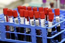 Hungarian scientist katalin karikó, who made coronavirus vaccines possible, spent 40 years working and developing key breakthroughs for moderna and biontech injections. The Story Of Mrna From A Loose Idea To A Tool That May Help Curb Covid