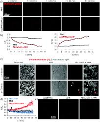 Multifunctional Temozolomide Loaded Lipid Superparamagnetic