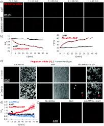 multifunctional temozolomide loaded lipid superparamagnetic