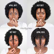 How this product supports black hair growth. 1 Year Natural Hair Growth Comparison Black Hair Information
