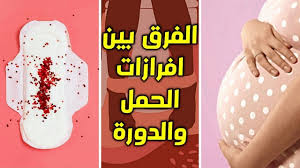 افرازات الحمل قبل الدورة والفرق بين افرازات الحمل وافرازات الدوره epis case phone phone cases