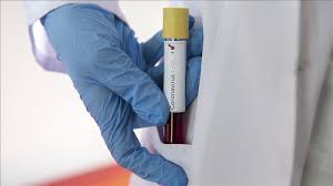 نتیجه جستجوی لغت [nears] در گوگل