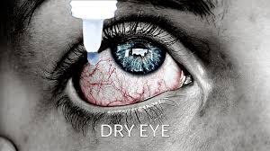 Image result for Dry Eye