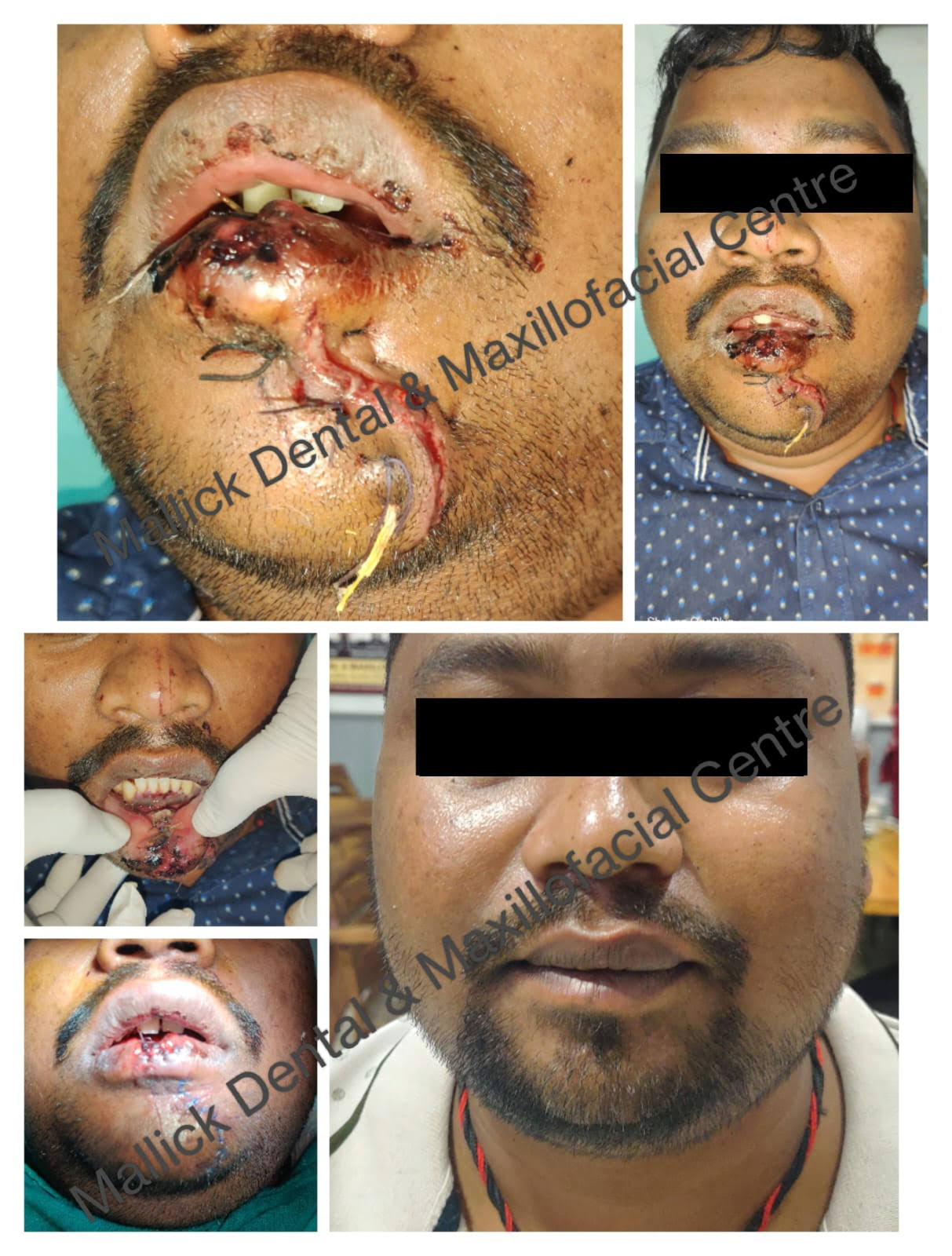 Oral & Maxillofacial Surgery product image