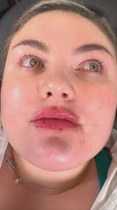 Whitney Mathis (@whitneynurseinjector) · Tyler, TX