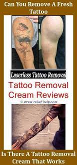 Our office serves bellevue, seattle, and surrounding areas in washington. Tattoo Removal Seattle Tattoo Removal Doctor Precision Laser Tattoo Removal Removable Tattoo Ink Painless Tattoo Removal Cost Laser Tattoo Removal Laser Tattoo