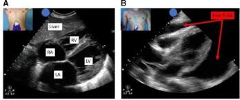 Image result for FAST Exam