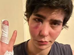 Fundraiser for Daje Schoormann by helene zumbusch : Support İrem after  having suffered a queerphobic assault