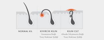 Tiras Makinesine Bagli Sislik Ve Kil Donmesi Gillette Turkiye