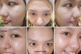 Avoskin dll, review nya ada kok di blog. Beauty Review Pemakaian Sebulan Avoskin Miraculous Retinol Ampoule A Lot Of Stories From Zakia