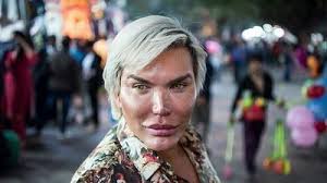 Rodrigo alves, que agora prefere ser chamada de roddy, detalhou as novas cirurgias que terá que fazer o apresentador rodrigo alves já se submeteu a mais de 70 cirurgias. Rodrigo Alves Human Ken Zeigt Bilder Von Fruher Videomapster