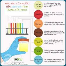 Màu sắc của nước tiểu cảnh báo tình trạng sức khỏe của bạn