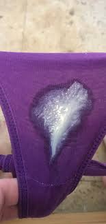 Vaginal Discharge – normal?! TMI w PICTURE!!!