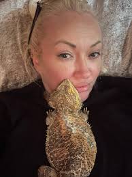 Does anyone know the name of Kane's doctor who he saw to get his burn scars  removed? I have a scar I want looking at.