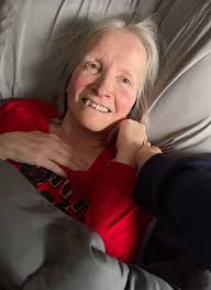 Is anyone familiar with myoclonus in Alzheimer's patients?