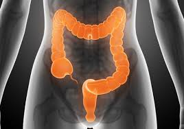 La sindrome del colon irritabile però avere sintomi variabili, non solo per tipologia ma anche per frequenza e gravità. Coliche E Colon Irritabile 10 Alimenti Da Evitare Vivere Piu Sani