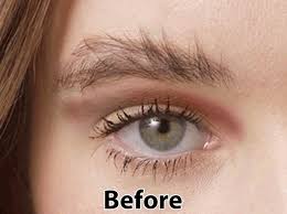 There are several medical conditions that can actually lead to hair loss, including eyelash and eyebrow thinning or loss: Thin Lizzy Perfect Brows Hair Remover 50 Off Sale