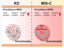 Image result for Multisystem Inflammatory Syndrome