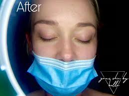 Isabelle Perry (@yourskinbybelle) • Instagram photos and videos