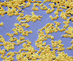 Image result for Corynebacterium