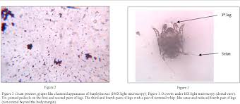 Image result for what do otodectes cynotis look like in dog fur