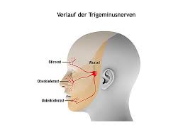 Mund Und Gesichtsschmerzen
