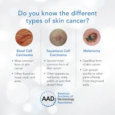 Although the percentage of cases in men is much lower than in women, male breast cancer accounts for a por. Aad On Twitter Skin Cancer Is The Most Common Cancer In The Us Learn More About The Different Types And The Signs To Look For Https T Co Id8olv8ocg Skincancerawarenessmonth Https T Co Yjrcyjkz05 Twitter